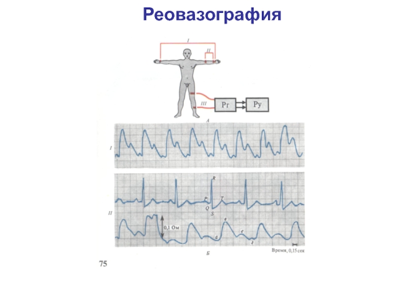 Реовазография