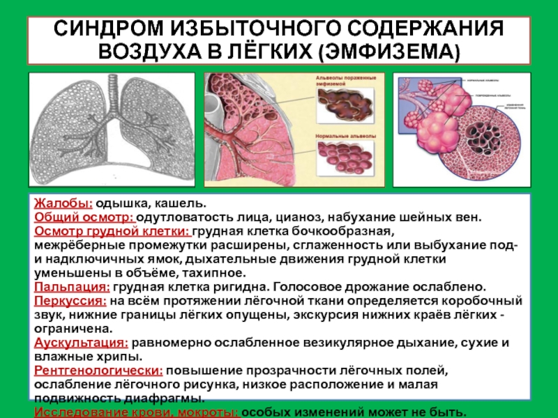 Синдром изменения легочного рисунка