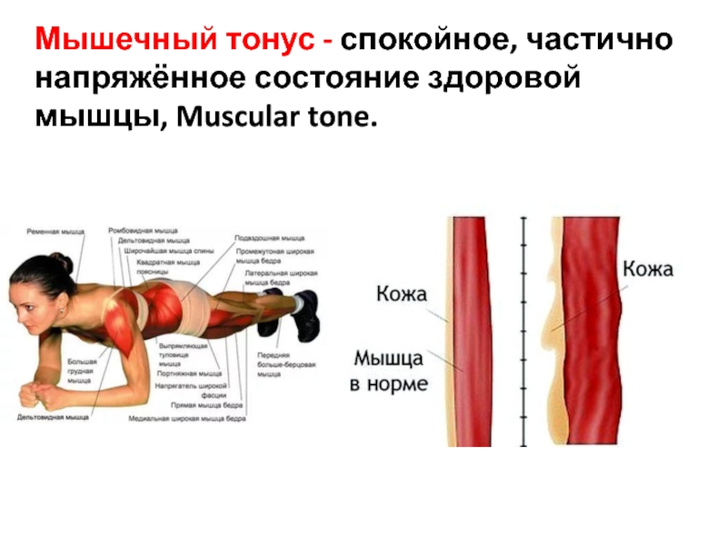 Можно греть мышцы. Мышечный гипертонус. Тонус мышц. Мышечный тонус гипертонус. Нормальный тонус мышц.