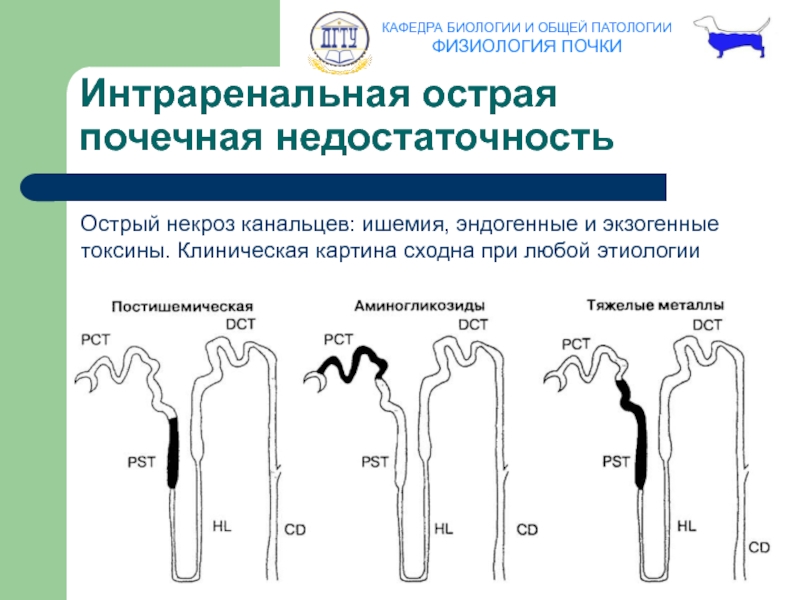 Клиническая картина опн