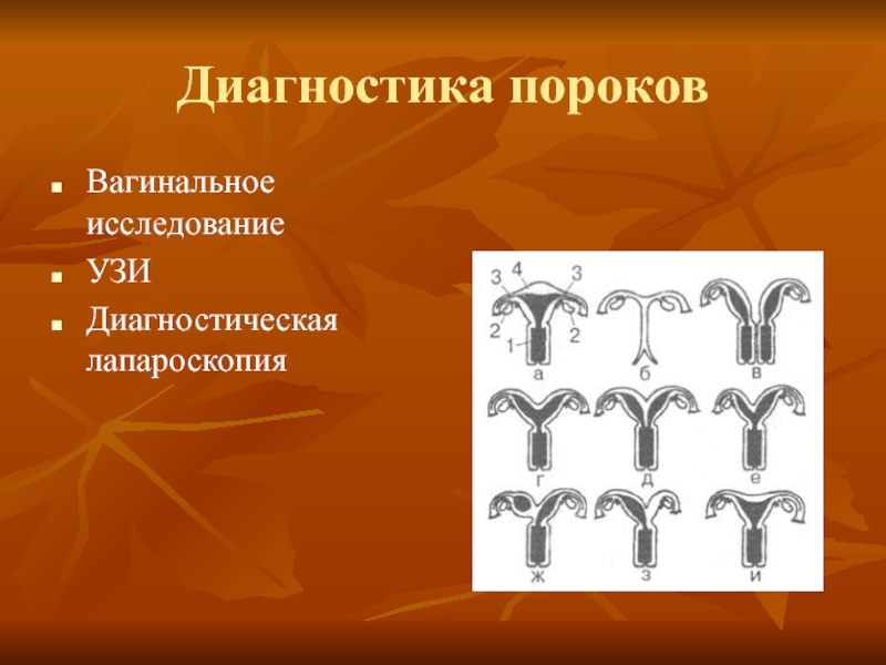 Аномалии развития женской репродуктивной системы презентация