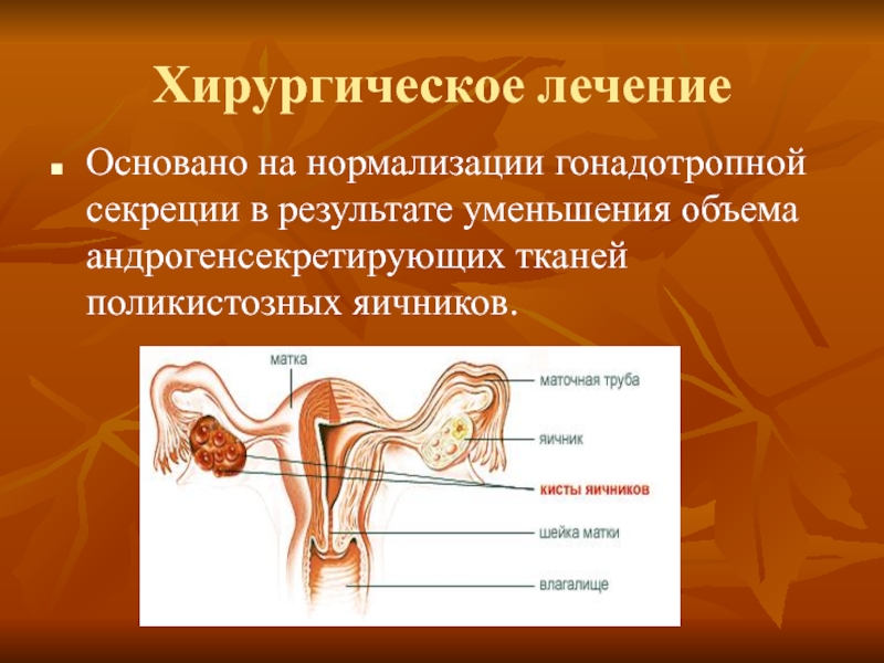 Аномалии развития яичников презентация