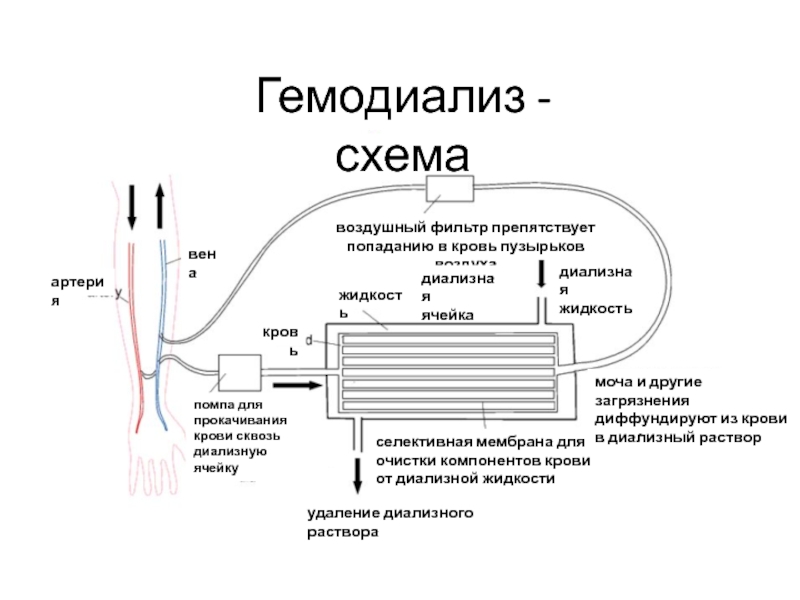 Диализ схема проведения