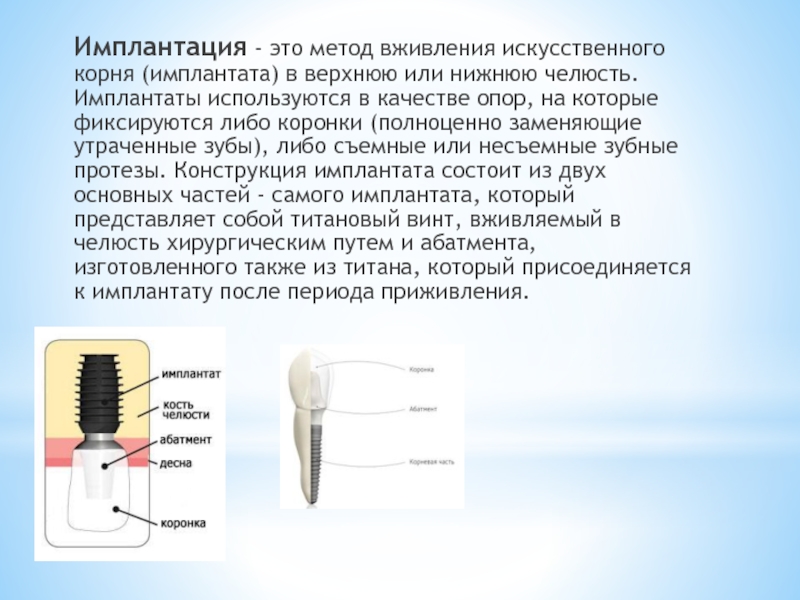 Имплантация основы