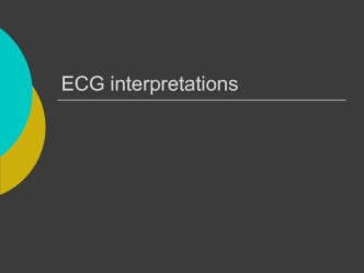 Ecg interpretations. How to analyze a rhythm. Normal sinus rhythm. Heart arrhythmias. Diagnosing a myocardial infarction