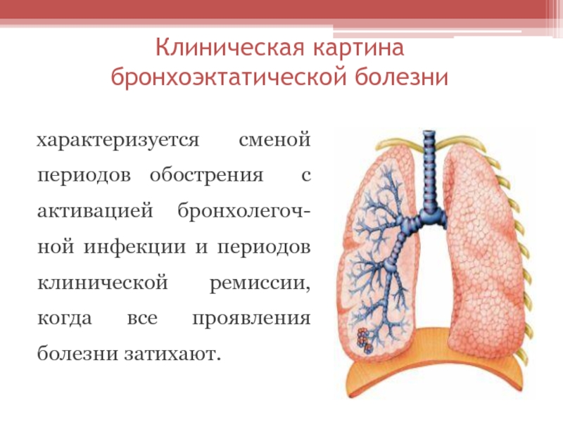 Бронхоэктазы нижней доли