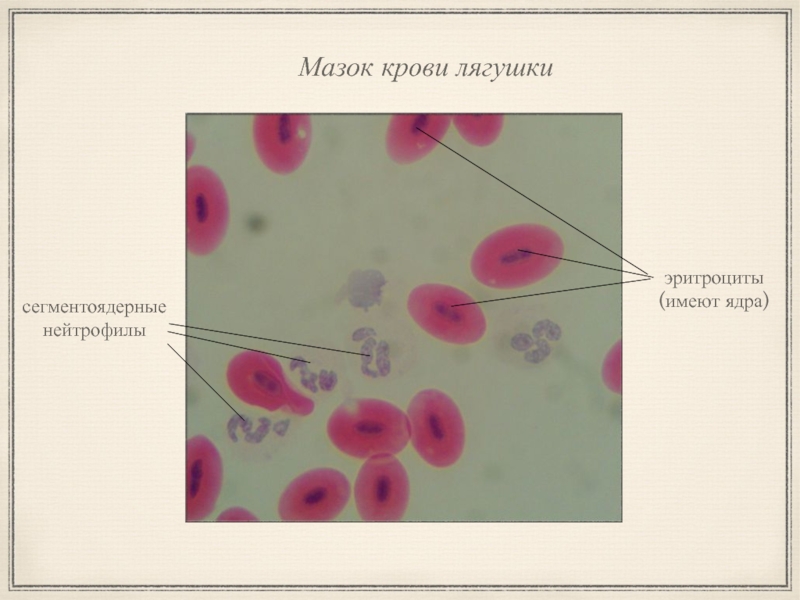 Эритроциты в мазке. Кровь лягушки гистология препарат. Мазок крови лягушки гистология. Форменные элементы крови мазок крови лягушки. Мазок крови лягушки под микроскопом.