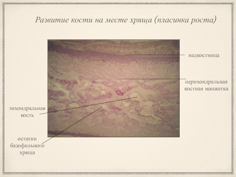 Развитие кости на месте хряща гистология рисунок