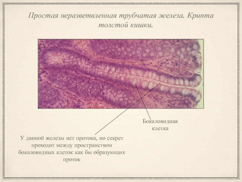 Простые трубчатые железы. Неразветвленные железы гистология. Простая неразветвленная трубчатая железа. Простая неразветвленная трубчатая железа толстая к шка. Простая трубчатая неразветвленная железа крипта толстая кишка.