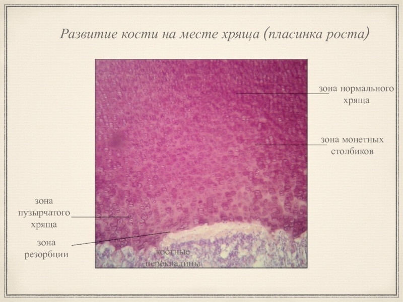 Развитие кости на месте хряща гистология рисунок