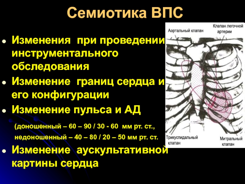 Аускультативная картина пороки сердца