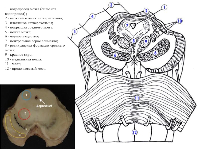 Средний мозг срез схема