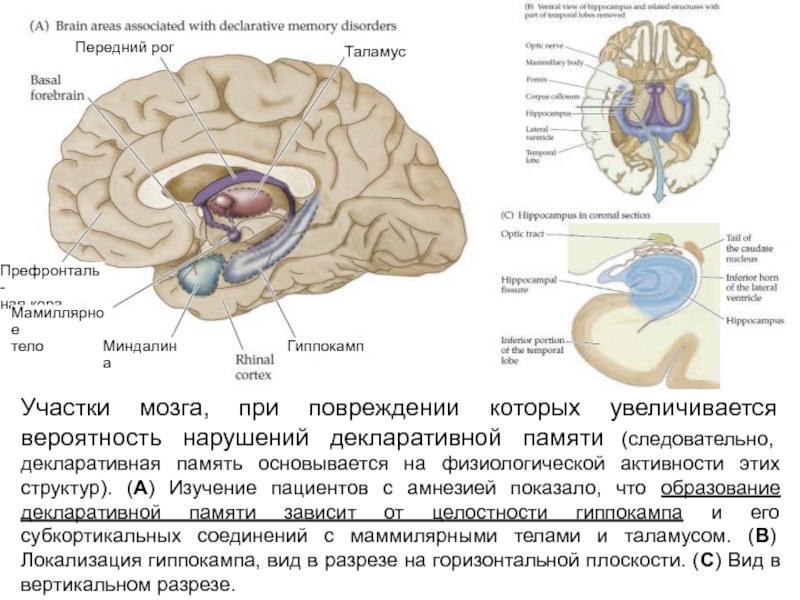 Повреждение гиппокампа. Таламус и гиппокамп. Гиппокамп на разрезе мозга. Функции гиппокампа головного мозга. Гиппокамп и миндалина.