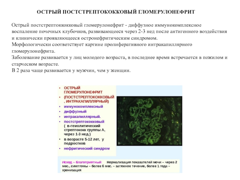 Острый постстрептококковый гломерулонефрит у детей