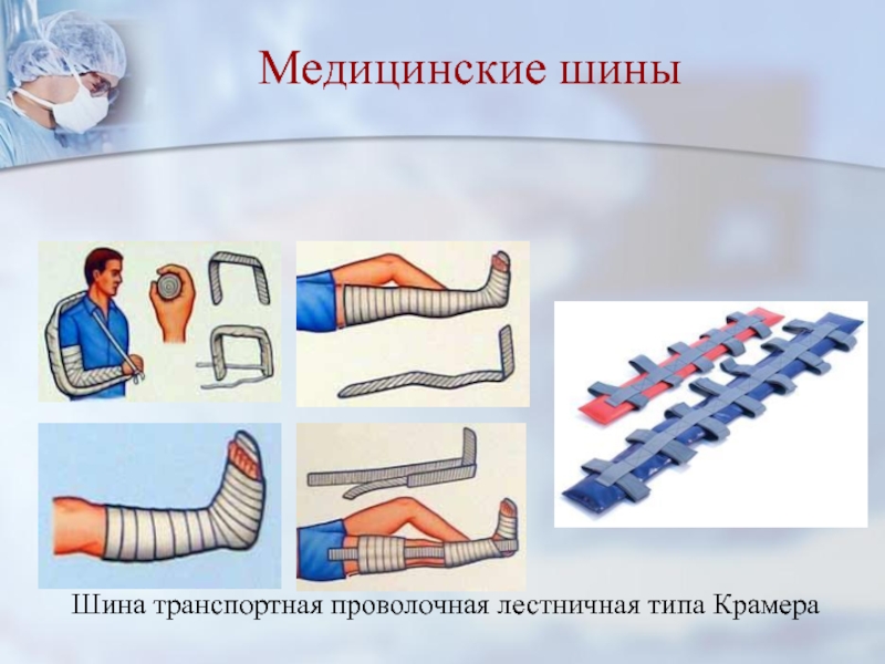 Современные средства транспортной иммобилизации