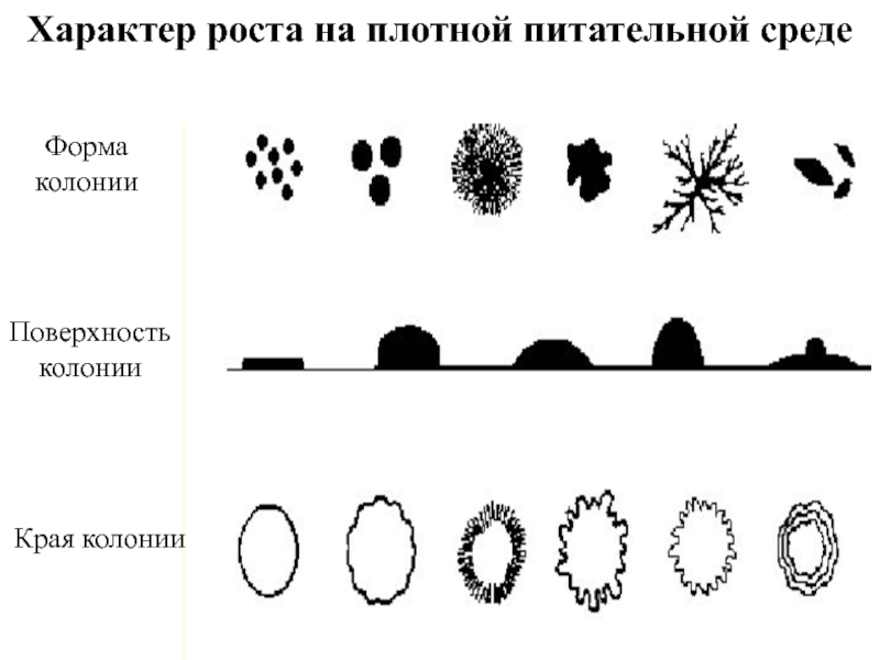 Схема описания колоний бактерий