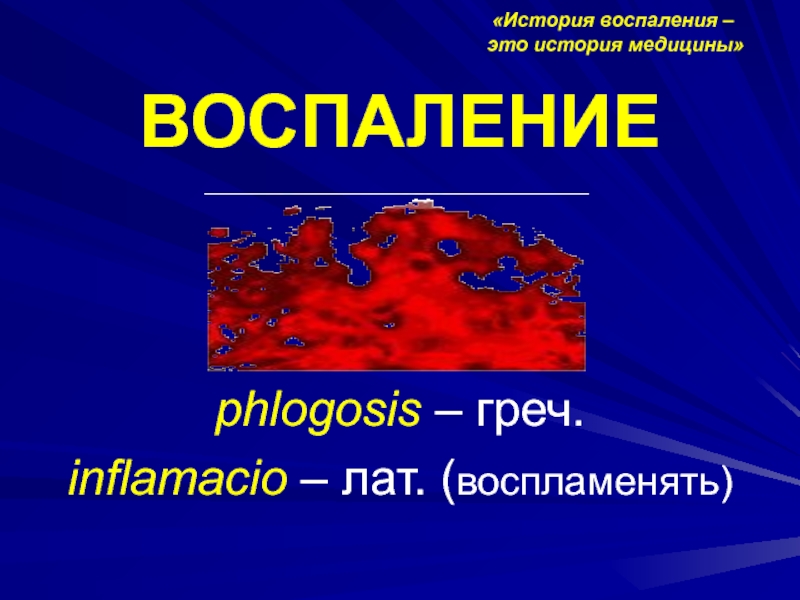 Воспаление картинки для презентации