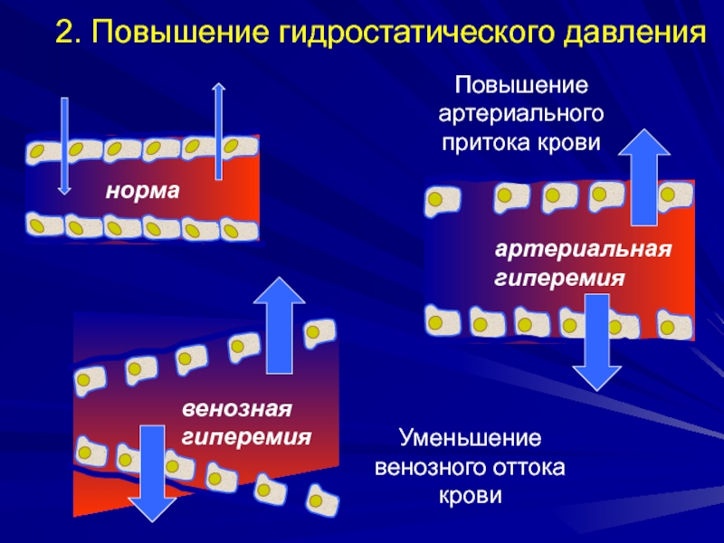 Увеличение 2. Повышение гидростатического давления крови. Уменьшение притока артериальной крови. Уменьшение венозного притока. Увеличение притока артериальной крови.