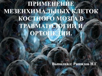 Применение мезенхимальных клеток костного мозга в травматологии и ортопедии