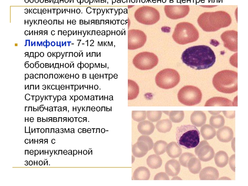 Лимфоциты структура. Лимфоциты в крови гистология. Лимфоциты гистология препарат. Лимфоциты ядро. Форма ядра лимфоцитов.