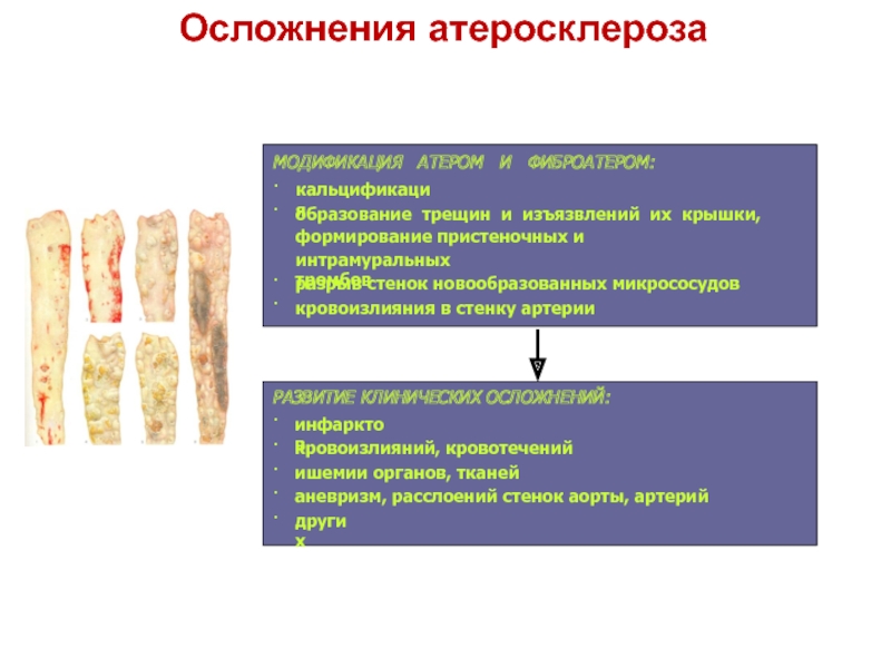 Патофизиология атеросклероза презентация