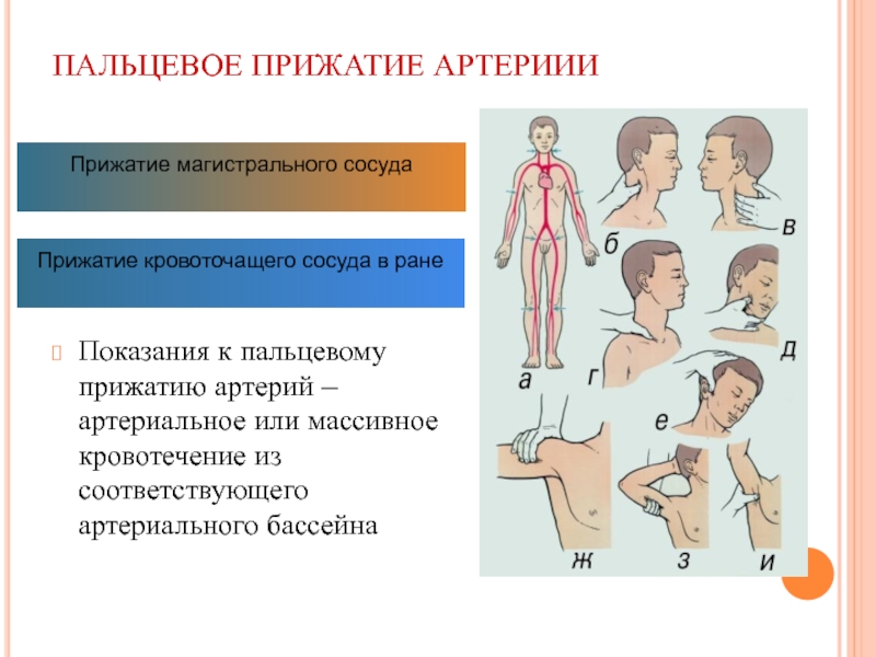 Фото пальцевое прижатие артерии