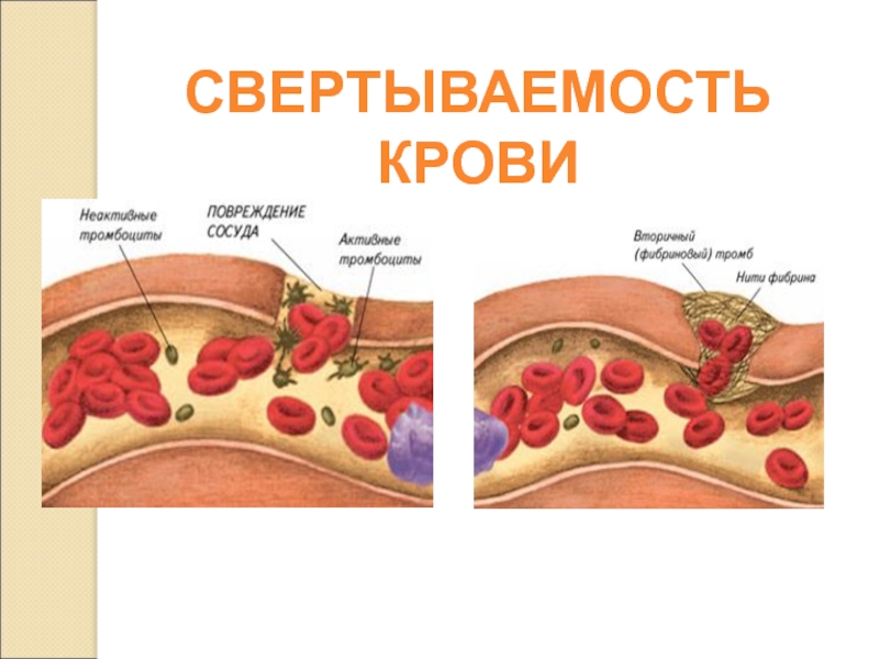 Плохая свертываемость