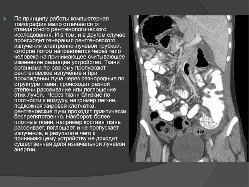 Компьютерная томография показания