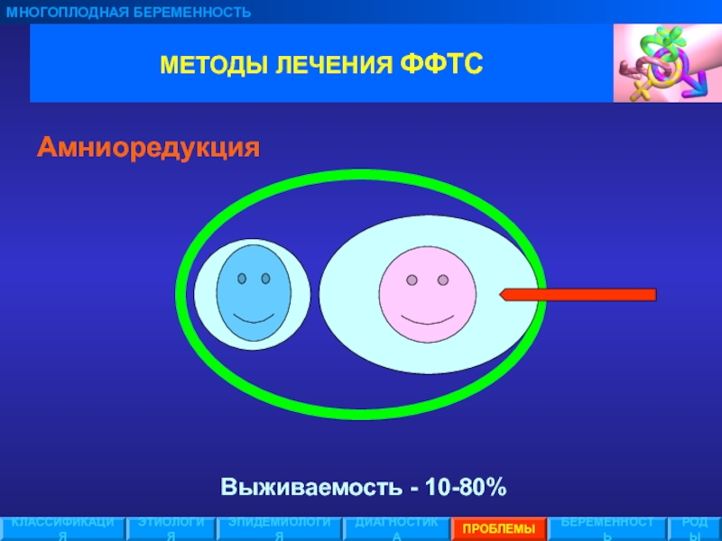 Фето фетальный трансфузионный синдром. Этиология и классификация многоплодной беременности. Эпидемиология многоплодной беременности. Амниоредукция при ФФТС.