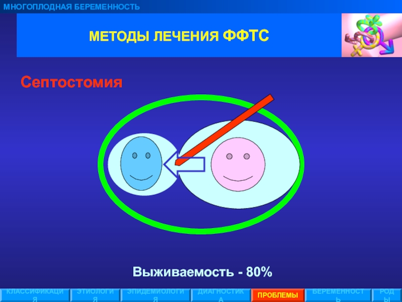 Фето фетальный трансфузионный синдром. Этиология и классификация многоплодной беременности. Многоплодная беременность классификация диагностика. Эпидемиология многоплодной беременности.