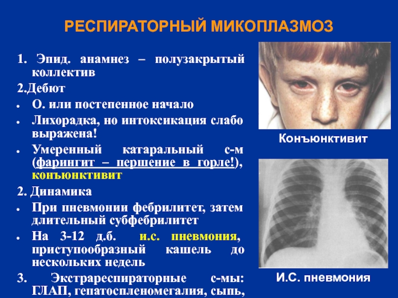 Катарально респираторный синдром презентация