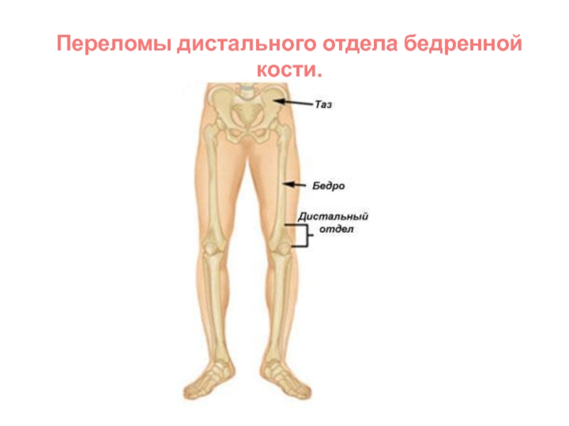 Бедренный отдел. Дистальный отдел бедра. Дистальный отдел бедренной кости. Средняя треть бедра.