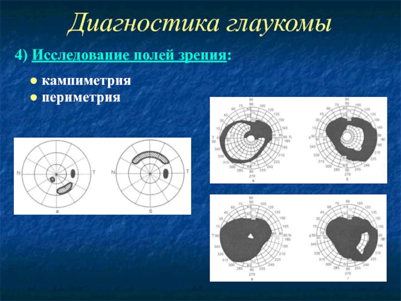 Исследование полей зрения. Методы ранней диагностики глаукомы. Исследование полей зрения кампиметрия. Диагностические алгоритм глаукомы. Раннее выявление глаукомы проводится с помощью.