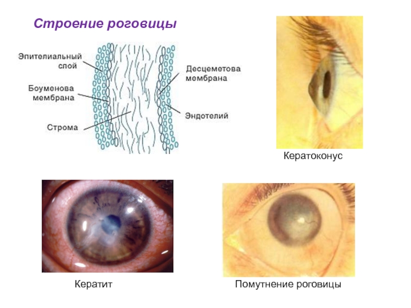 Слои роговицы схема