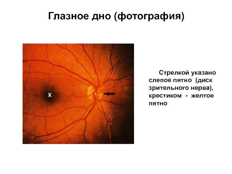 В чем особенность слепого пятна какую функцию. Диск зрительного нерва и желтое пятно. Желтое пятно Центральная ямка на глазном дне.