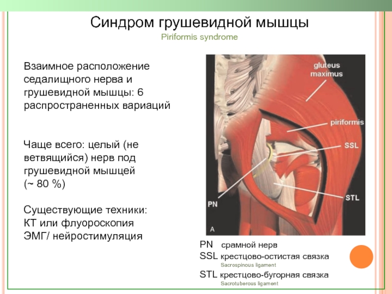 Грушевидная мышца где находится фото