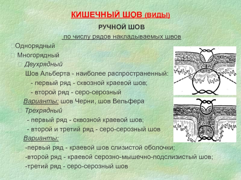 Кишечные швы топографическая анатомия