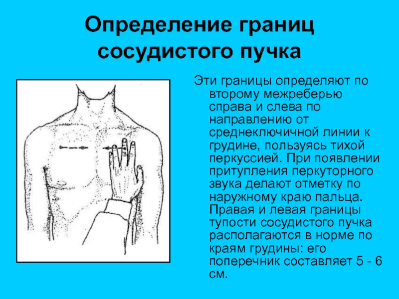 Сосудистый пучок. Ширина сосудистого пучка. Перкуссия сосудистого пучка. Границы сосудистого пучка. Пальпация сосудистого пучка.