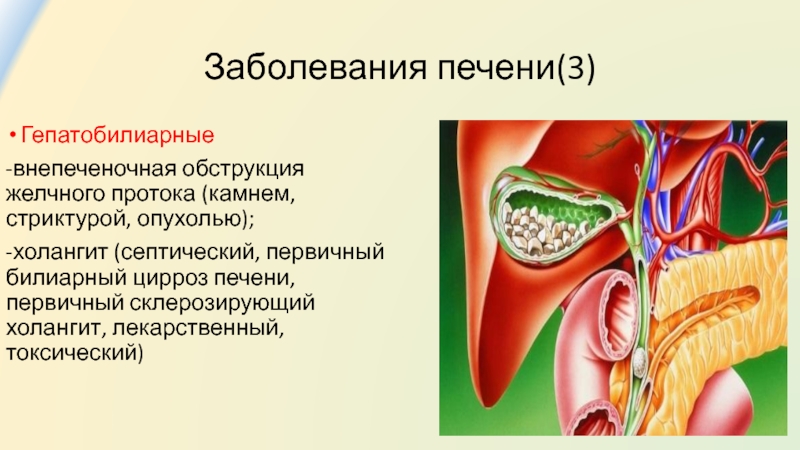 Заболевания печен. Гепатобилиарная система заболевания. Заболевания гепатобилиарной зоны. Заболевания гепатобилиарной системы симптомы.