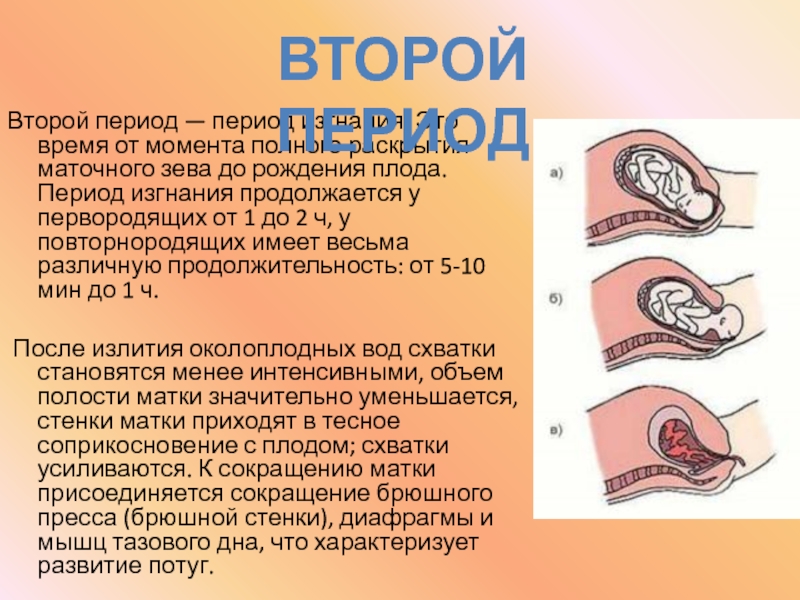 Категория родов. Второй период родов изгнание плода. Раскрытие маточного зева. Период изгнания раскрытие маточного зева. Полное открытие маточного зева.