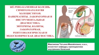 Жёлчно-каменная болезнь. Холециститы, панкреатиты, энтериты