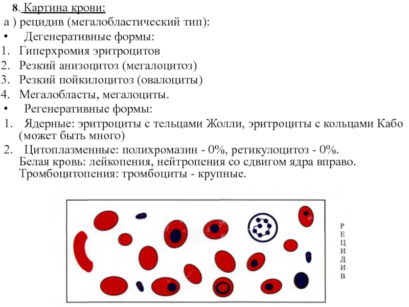 На рисунке изображены эритроциты. Анизоцитоз, пойкилоцитоз, тельца Жолли, кольца Кебота. Эритроциты с тельцами Жолли. Формы эритроцитов пойкилоцитоз. Нейтропения картина крови.