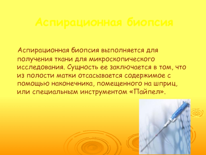 Аспирационная биопсия. Аспирационная катетеризационная биопсия. Аспирационная биопсия из полости матки.