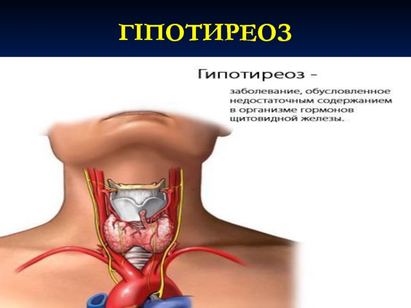 Где находится щитовидная железа у мужчин фото