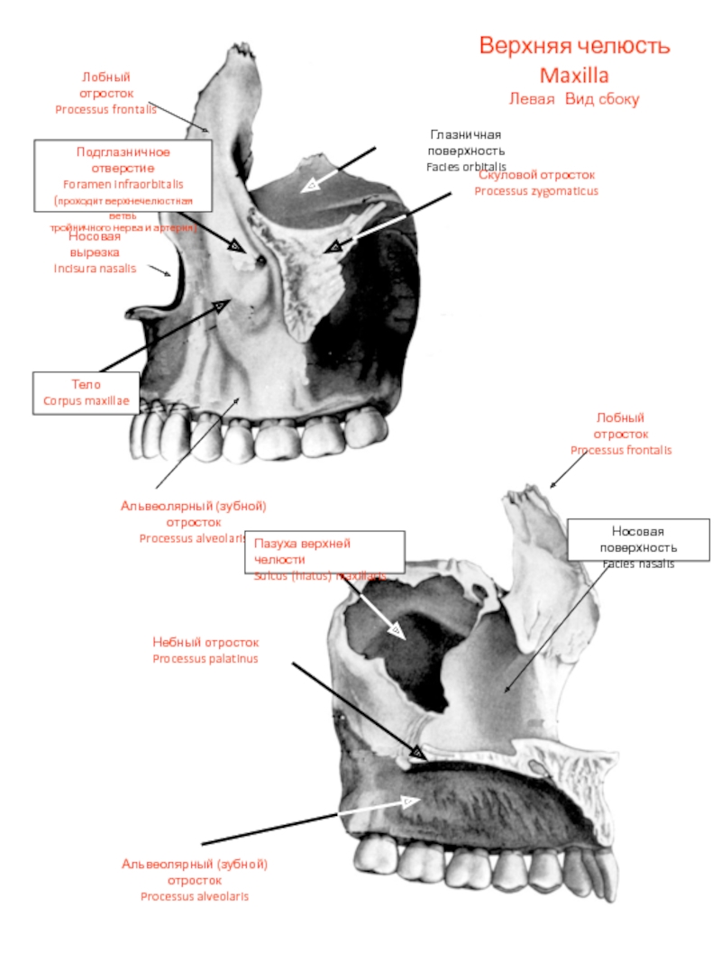 Верхняя челюсть анатомия. Строение верхнечелюстной кости. Верхняя челюсть (Maxilla). Клыковая ямка верхней челюсти. Носовая вырезка верхней челюсти.