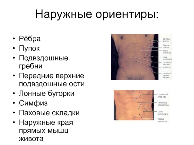 Правая подвздошная область. Внешние ориентиры живота. Наружные края прямых мышц живота. Границы и наружные ориентиры живота.