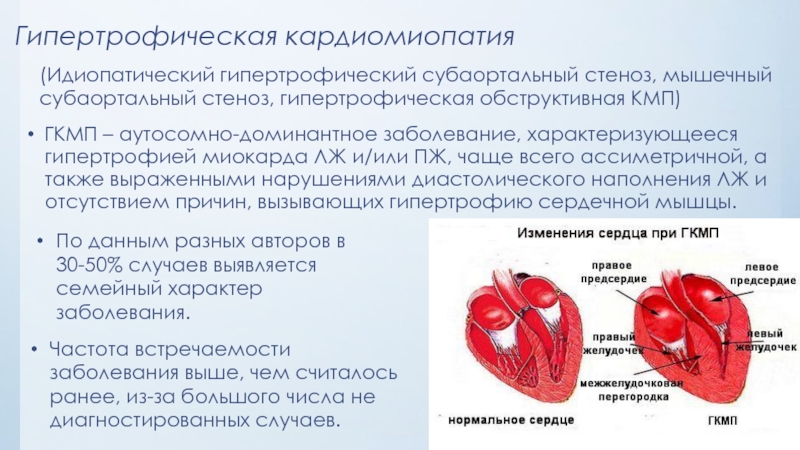 Реферат: Идиопатическая кардиомиопатия