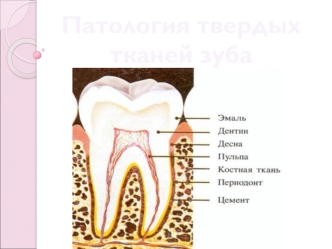 Патология твердых тканей зуба