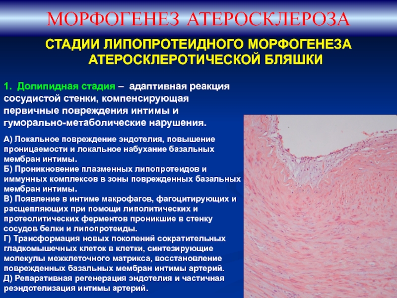 Стадии атеросклероза картинки