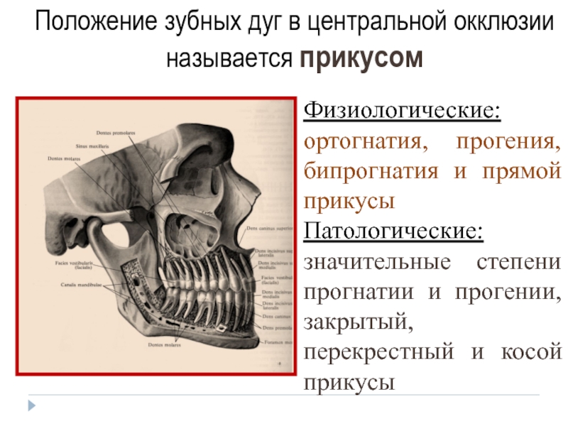 Положение зубных дуг в центральной окклюзии это. Центральная окклюзия и центральное соотношение челюстей. Физиологическая прогения.